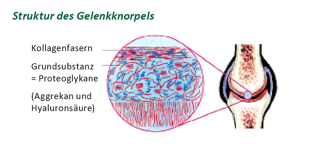 CarniMed - Kollagenfasern im Gelenkknorpel Aufbau eines Gelenkknorpels